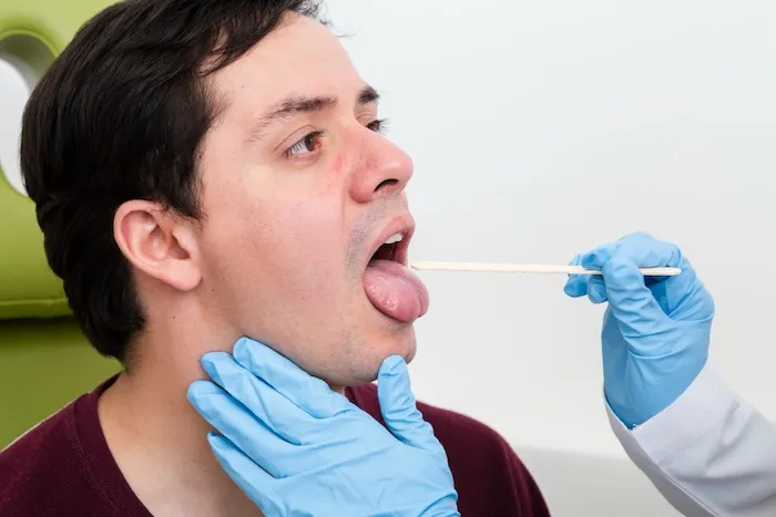 Revisión oral para enfermedades infecciosas en boca